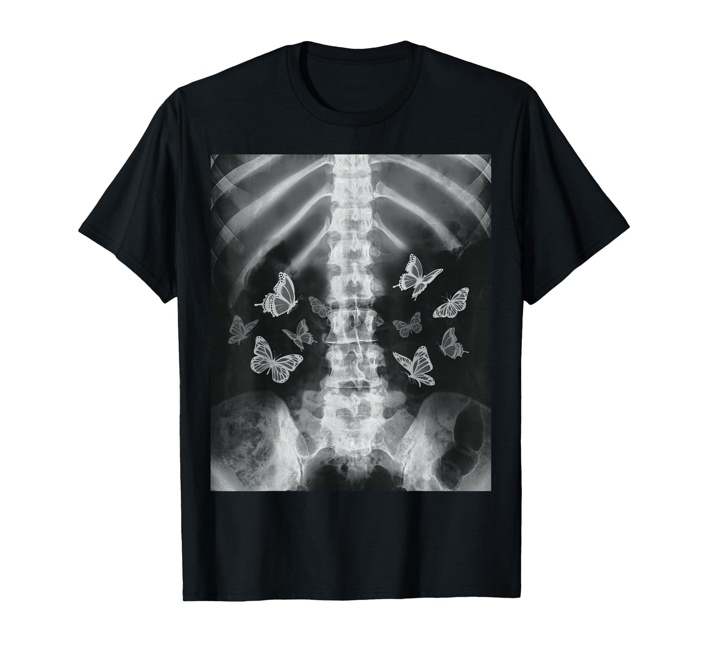 Skeleton Xray Butterfly Egirl Y2K T-Shirt - Streetwear Style Men Women - T-Shirt, Sweatshirt, Hoodie